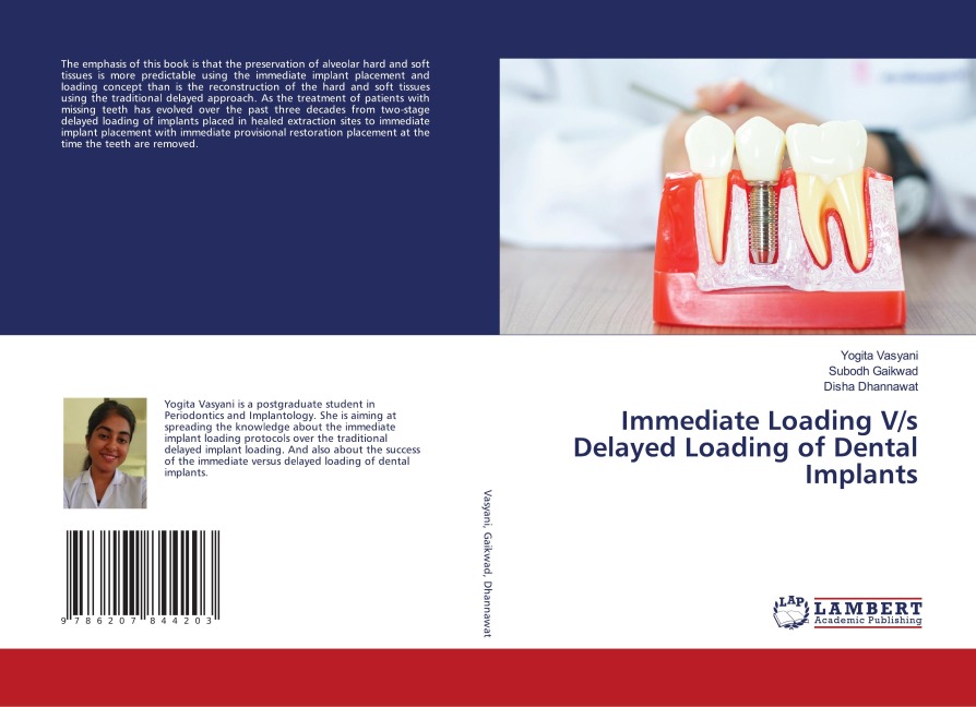 Immediate Loading V/s Delayed Loading of Dental Implants
