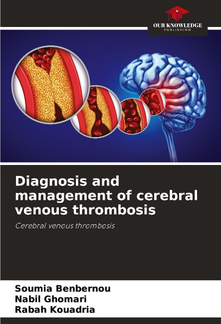 Diagnosis and management of cerebral venous thrombosis: Cerebral venous thrombosis