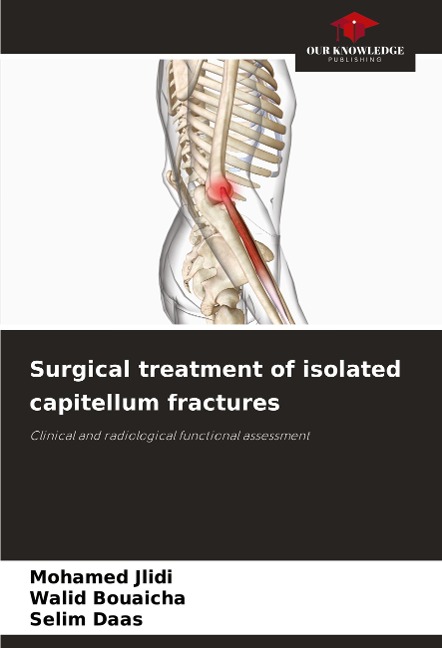Surgical treatment of isolated capitellum fractures: Clinical and radiological functional assessment