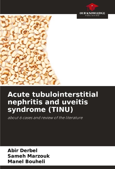 Acute tubulointerstitial nephritis and uveitis syndrome (TINU): about 6 cases and review of the literature