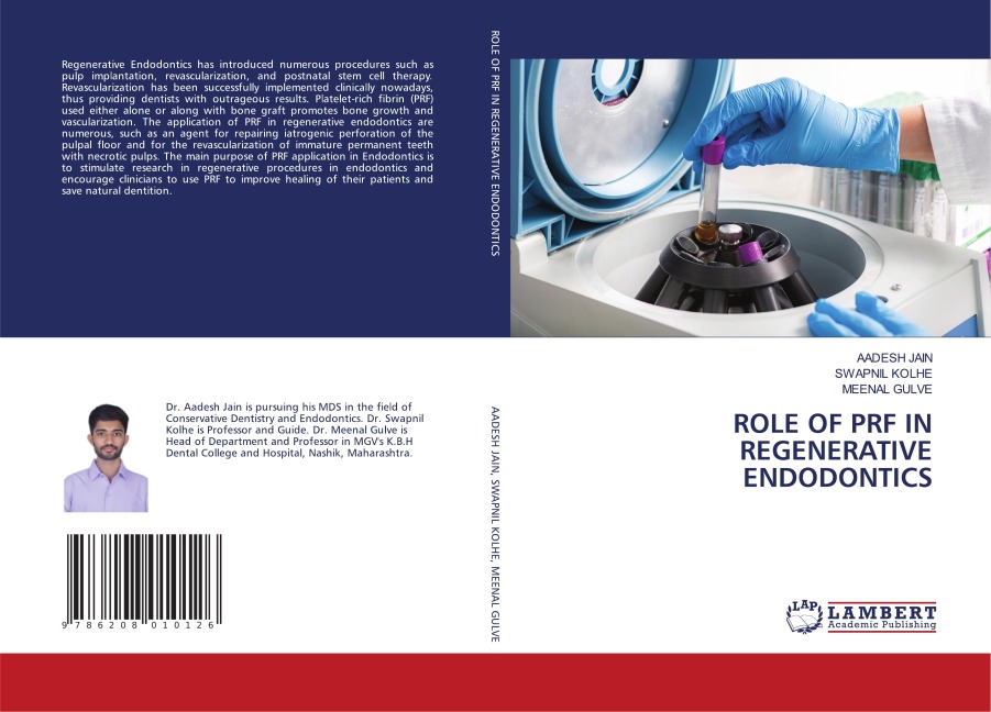 ROLE OF PRF IN REGENERATIVE ENDODONTICS