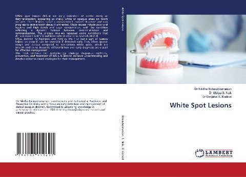 White Spot Lesions