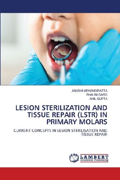 LESION STERILIZATION AND TISSUE REPAIR (LSTR) IN PRIMARY MOLARS: CURRENT CONCEPTS IN LESION STERILISATION AND TISSUE REPAIR