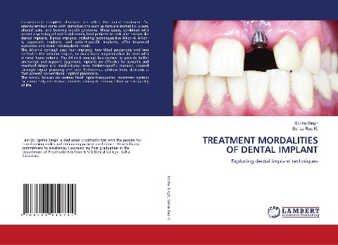 TREATMENT MORDALITIES OF DENTAL IMPLANT: Exploring dental implant techniques