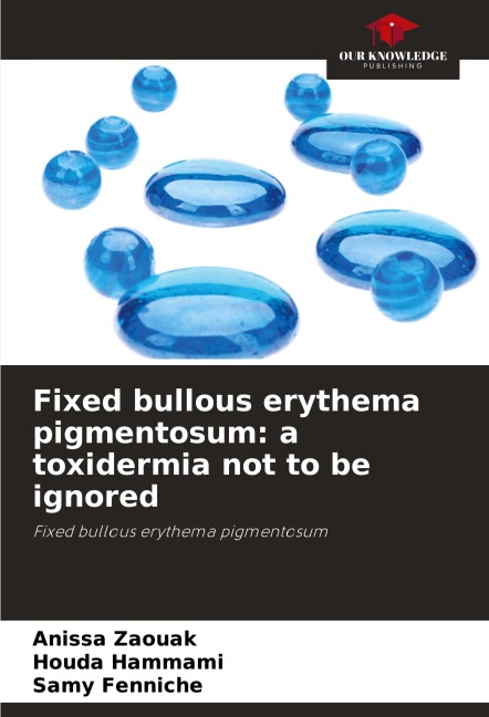 Fixed bullous erythema pigmentosum: a toxidermia not to be ignored: Fixed bullous erythema pigmentosum
