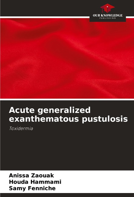 Acute generalized exanthematous pustulosis: Toxidermia