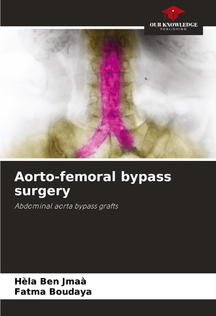 Aorto-femoral bypass surgery: Abdominal aorta bypass grafts