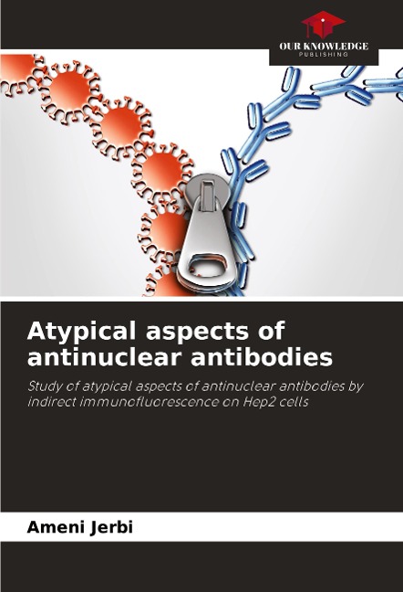 Atypical aspects of antinuclear antibodies: Study of atypical aspects of antinuclear antibodies by indirect immunofluorescence on Hep2 cells
