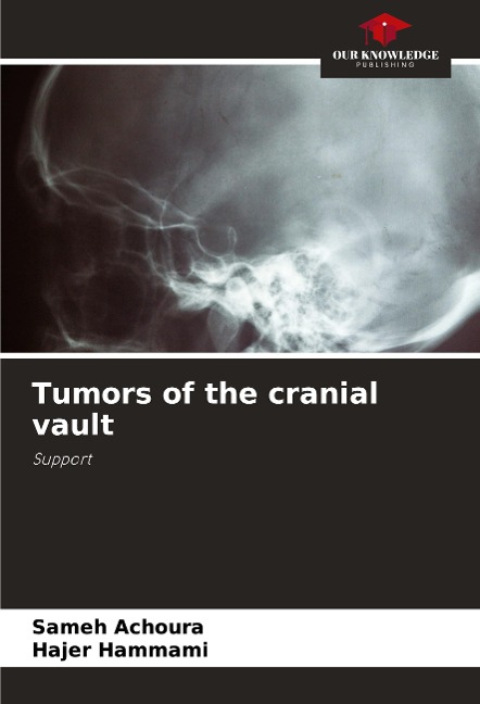 Tumors of the cranial vault: Support
