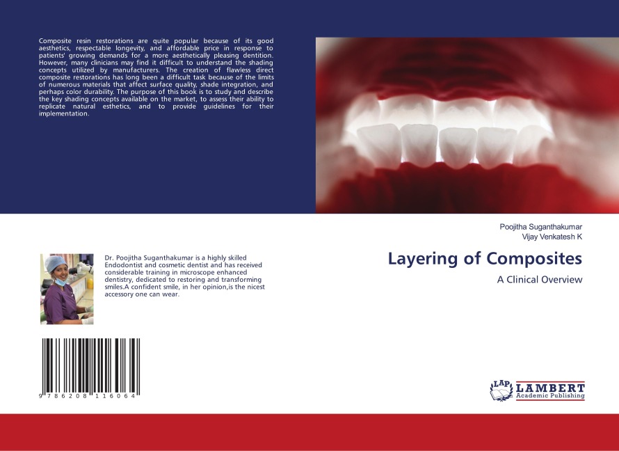 Layering of Composites: A Clinical Overview
