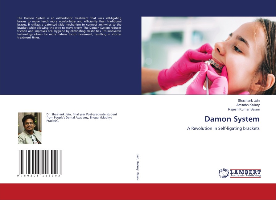 Damon System: A Revolution in Self-ligating brackets