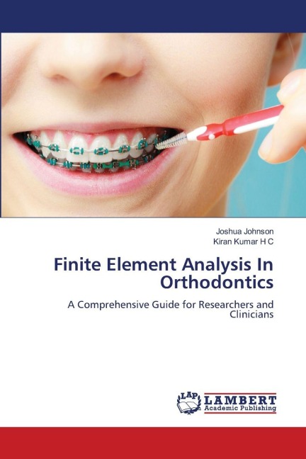 Finite Element Analysis In Orthodontics: A Comprehensive Guide for Researchers and Clinicians