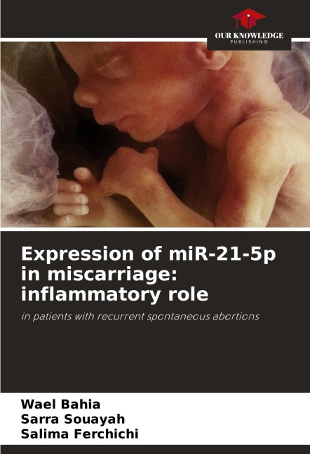 Expression of miR-21-5p in miscarriage: inflammatory role: in patients with recurrent spontaneous abortions