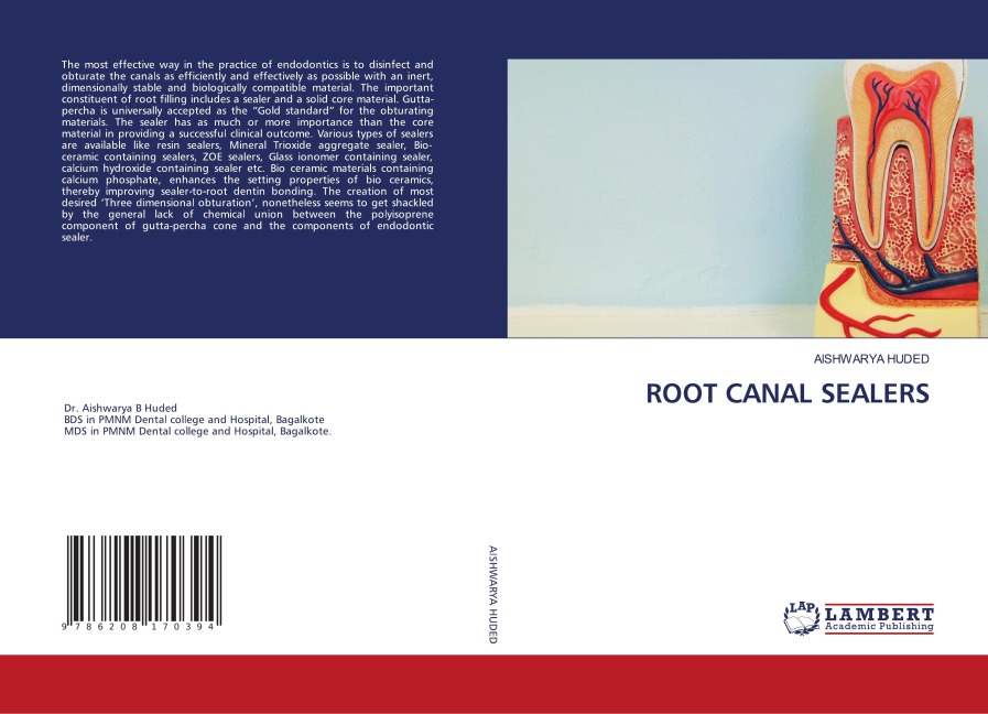 ROOT CANAL SEALERS