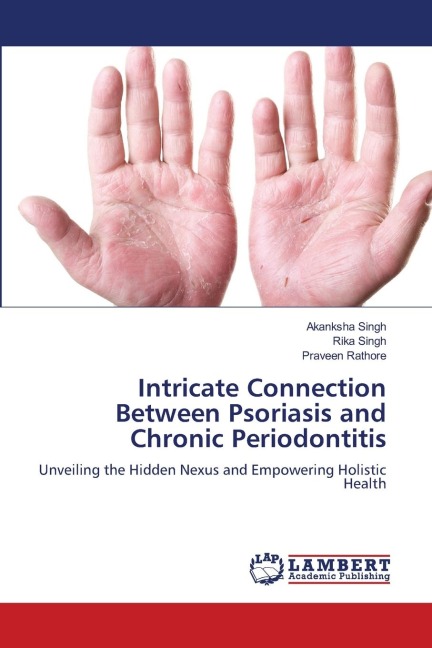 Intricate Connection Between Psoriasis and Chronic Periodontitis: Unveiling the Hidden Nexus and Empowering Holistic Health