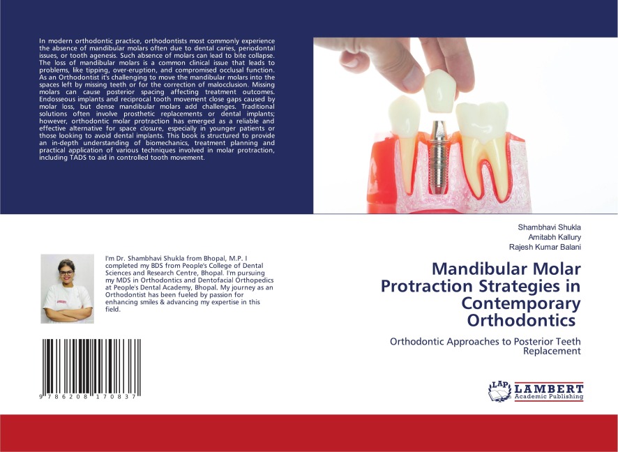Mandibular Molar Protraction Strategies in Contemporary Orthodontics: Orthodontic Approaches to Posterior Teeth Replacement