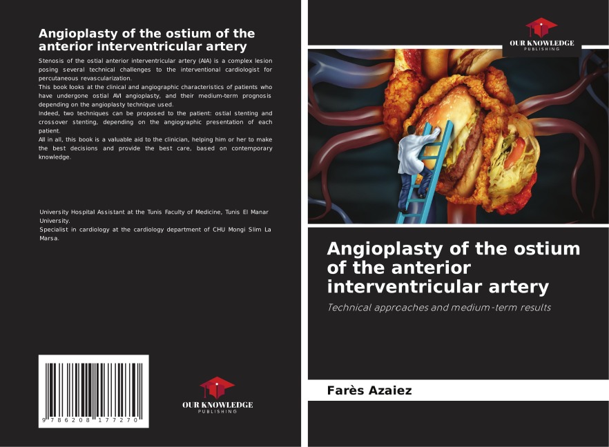 Angioplasty of the ostium of the anterior interventricular artery: Technical approaches and medium-term results