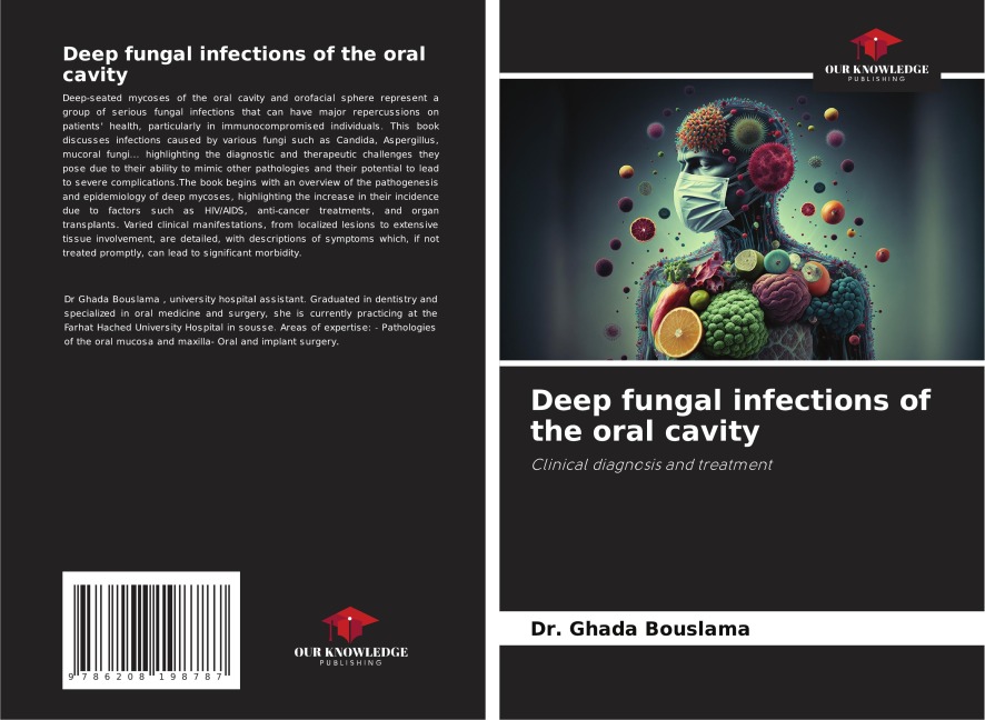 Deep fungal infections of the oral cavity: Clinical diagnosis and treatment