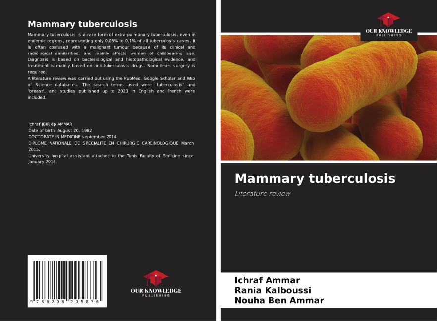 Mammary tuberculosis: Literature review