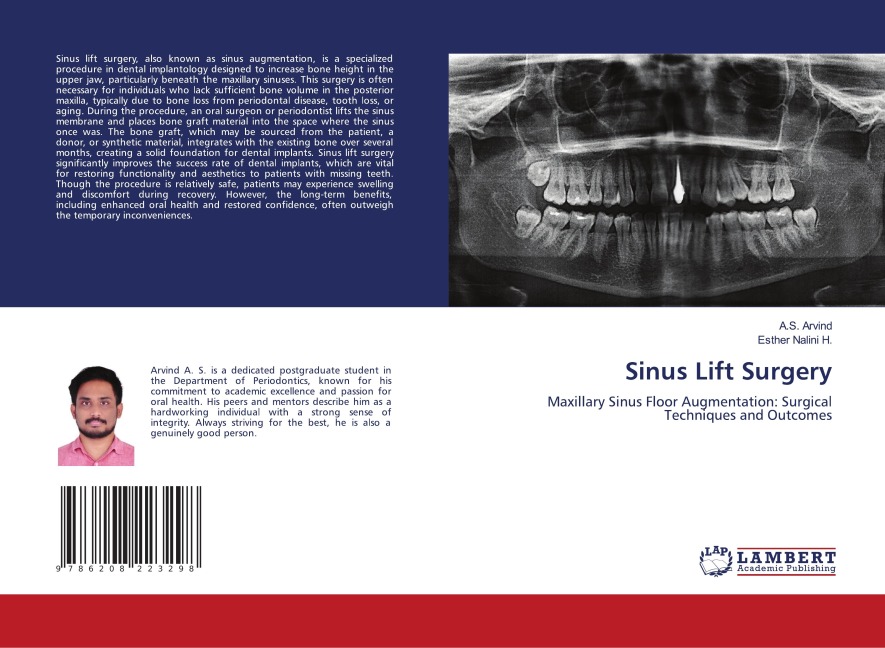 Sinus Lift Surgery: Maxillary Sinus Floor Augmentation: Surgical Techniques and Outcomes