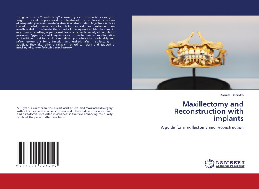 Maxillectomy and Reconstruction with implants: A guide for maxillectomy and reconstruction