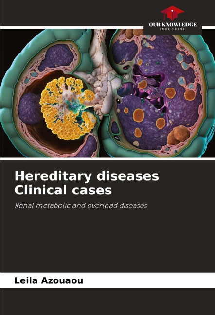 Hereditary diseases Clinical cases: Renal metabolic and overload diseases