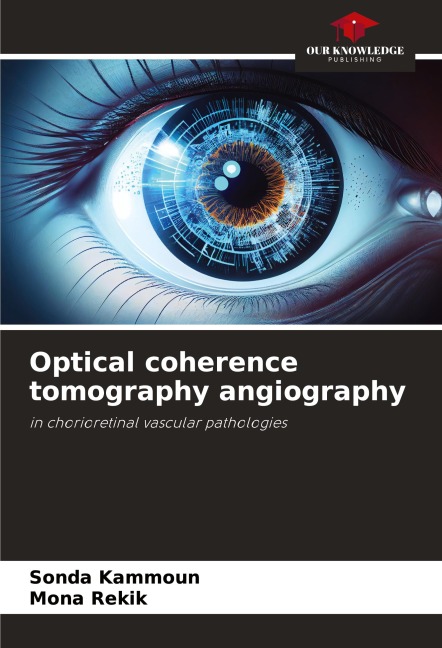 Optical coherence tomography angiography: in chorioretinal vascular pathologies