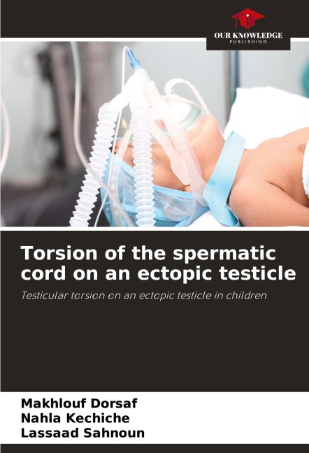 Torsion of the spermatic cord on an ectopic testicle: Testicular torsion on an ectopic testicle in children