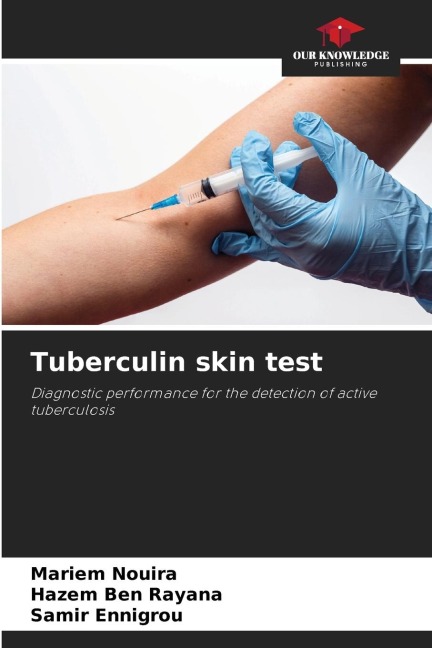 Tuberculin skin test: Diagnostic performance for the detection of active tuberculosis