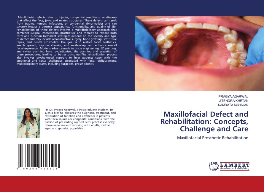 Maxillofacial Defect and Rehabilitation: Concepts, Challenge and Care: Maxillofacial Prosthetic Rehabilitation