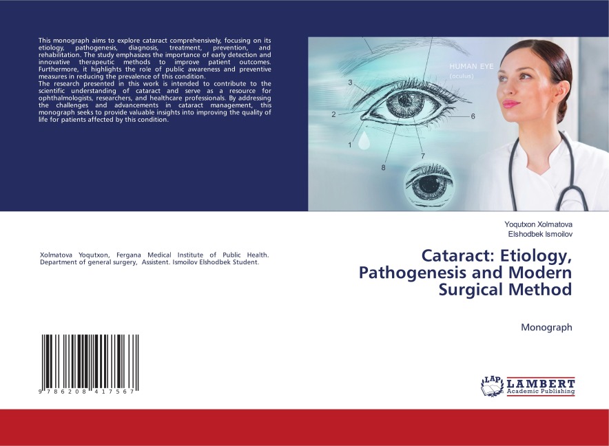 Cataract: Etiology, Pathogenesis and Modern Surgical Method: Monograph