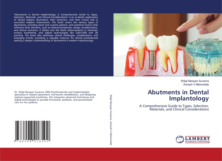 Abutments in Dental Implantology: A Comprehensive Guide to Types, Selection, Materials, and Clinical Considerations