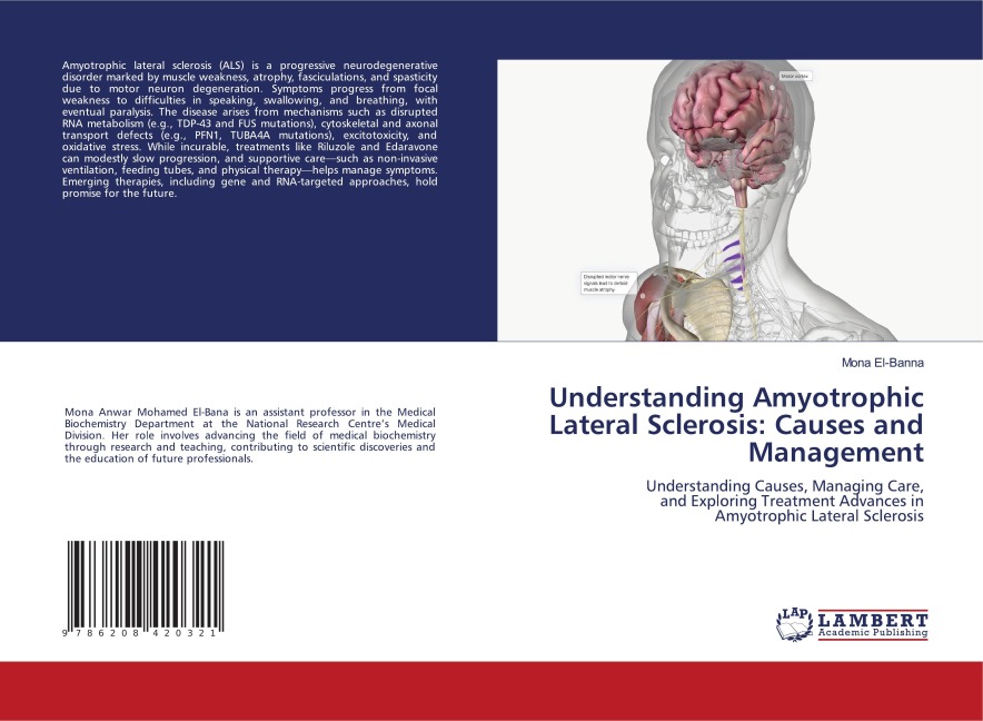 Understanding Amyotrophic Lateral Sclerosis: Causes and Management: Understanding Causes, Managing Care,and Exploring Treatment Advances inAmyotrophic Lateral Sclerosis