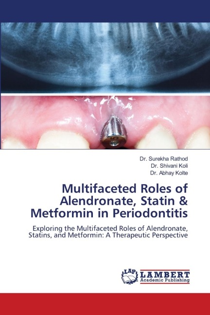 Multifaceted Roles of Alendronate, Statin & Metformin in Periodontitis: Exploring the Multifaceted Roles of Alendronate, Statins, and Metformin: A Therapeutic Perspective