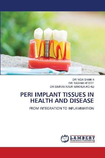 PERI IMPLANT TISSUES IN HEALTH AND DISEASE: FROM INTEGRATION TO INFLAMMATION