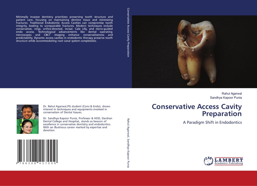 Conservative Access Cavity Preparation: A Paradigm Shift in Endodontics