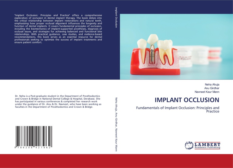 IMPLANT OCCLUSION: Fundamentals of Implant Occlusion: Principles and Practice