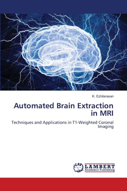Automated Brain Extraction in MRI: Techniques and Applications in T1-Weighted Coronal Imaging