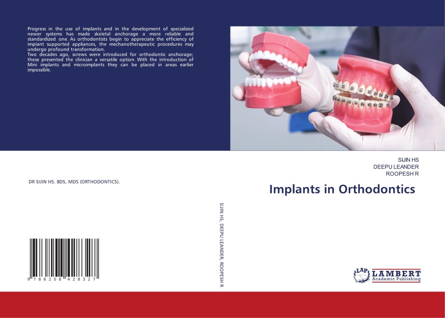 Implants in Orthodontics
