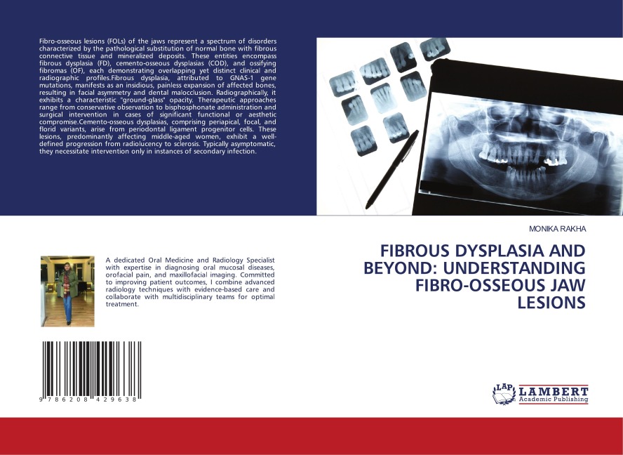 FIBROUS DYSPLASIA AND BEYOND: UNDERSTANDING FIBRO-OSSEOUS JAW LESIONS
