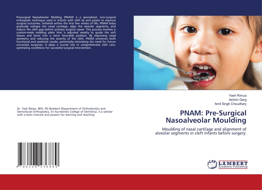 PNAM: Pre-Surgical Nasoalveolar Moulding: Moulding of nasal cartilage and alignment of alveolar segments in cleft infants before surgery.
