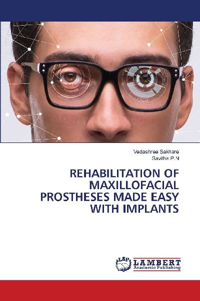 Rehabilitation of Maxillofacial Prostheses Made Easy with Implants