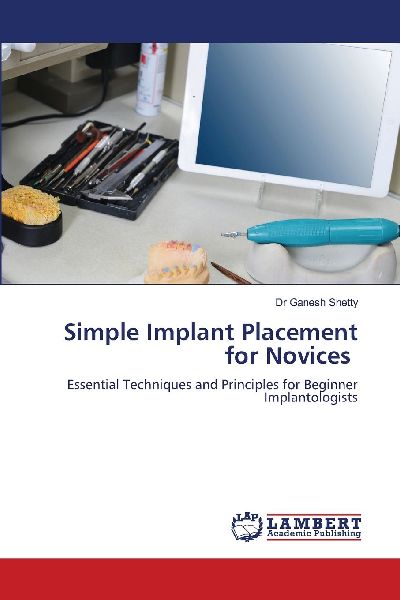 Simple Implant Placement for Novices: Essential Techniques and Principles for Beginner Implantologists