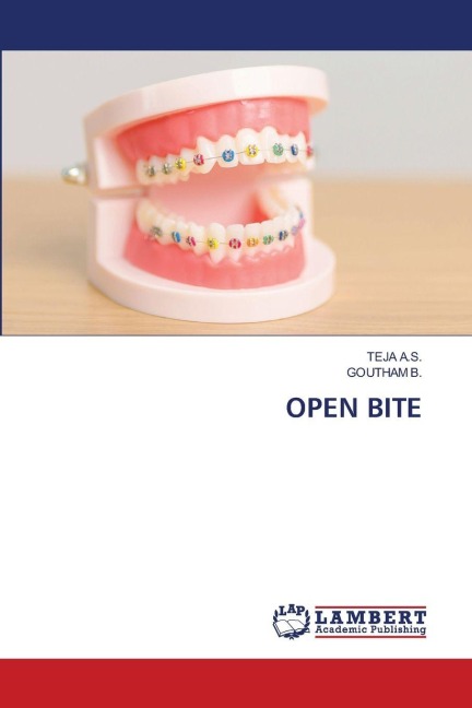 OPEN BITE