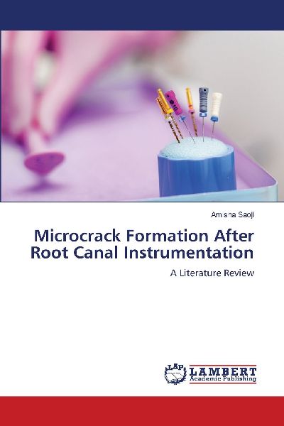 Microcrack Formation After Root Canal Instrumentation: A Literature Review