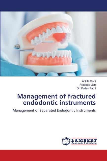 Management of fractured endodontic instruments: Management of Separated Endodontic Instruments