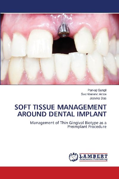 SOFT TISSUE MANAGEMENT AROUND DENTAL IMPLANT: Management of Thin Gingival Biotype as a Preimplant Procedure