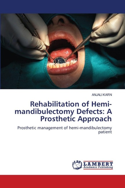 Rehabilitation of Hemi-mandibulectomy Defects: A Prosthetic Approach: Prosthetic management of hemi-mandibulectomy patient
