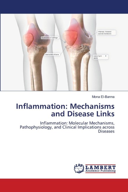 Inflammation: Mechanisms and Disease Links: Inflammation: Molecular Mechanisms, Pathophysiology, and Clinical Implications across Diseases