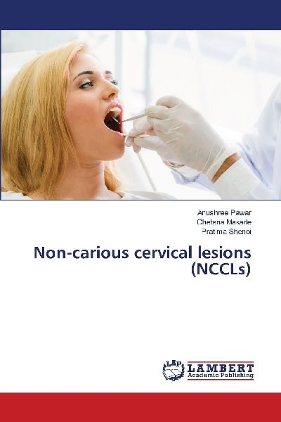 Non-carious cervical lesions (NCCLs)